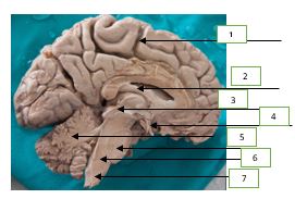 Brain Labeled Disection Identify the labeled parts of the dissected brain. | Homework.Study.com