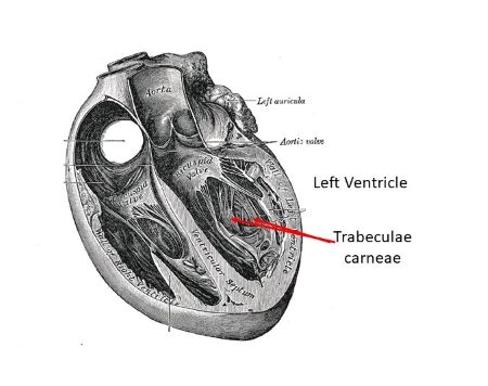 Trabeculae Carneae Definition Conus Arteriosus DDKGWB Trabeculae Carneae Definition Conus Arteriosus DDKGWB