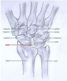 What bones articulate at the wrist joint? | Homework.Study.com
